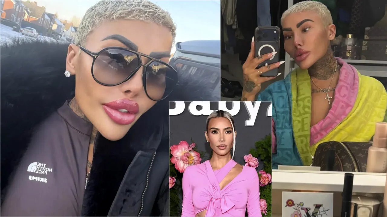 „Regele buzelor cu botox” a murit la doar 34 de ani. Britanicul a cheltuit 130.000 de lire sterline pentru a se transforma în Kim Kardashian