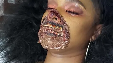 O dansatoare a ajuns de urgență la spital și a provocat panică în rândul medicilor, care au vrut să o opereze pe loc: „Ar fi trebuit să-și dea seama