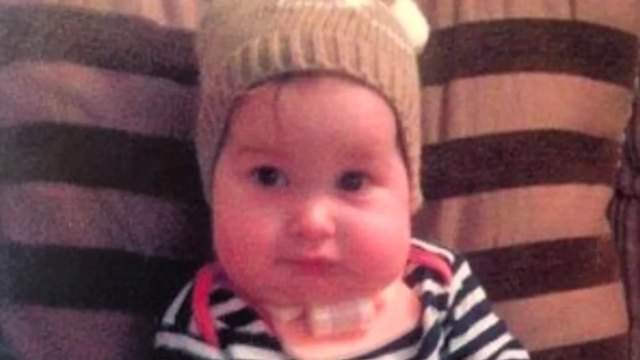 Povestea bebelușului care nu plânge niciodată. Este singurul copil din lume care suferă de această boală