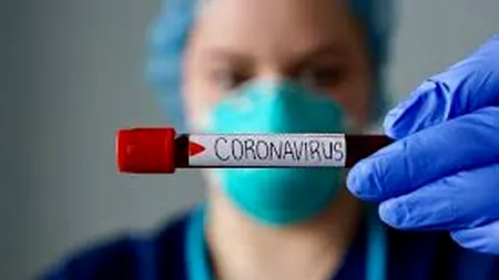 COMUNICAT DE PRESĂ. În 24 de ore, au fost înregistrate alte 320 de noi cazuri de îmbolnăvire. Au fost confirmate 23.400 de cazuri de persoane infectate cu virusul COVID – 19 pe teritoriul României