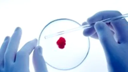 STUDIU. Testul care poate prezice dacă te îmbolnăvești de cancer