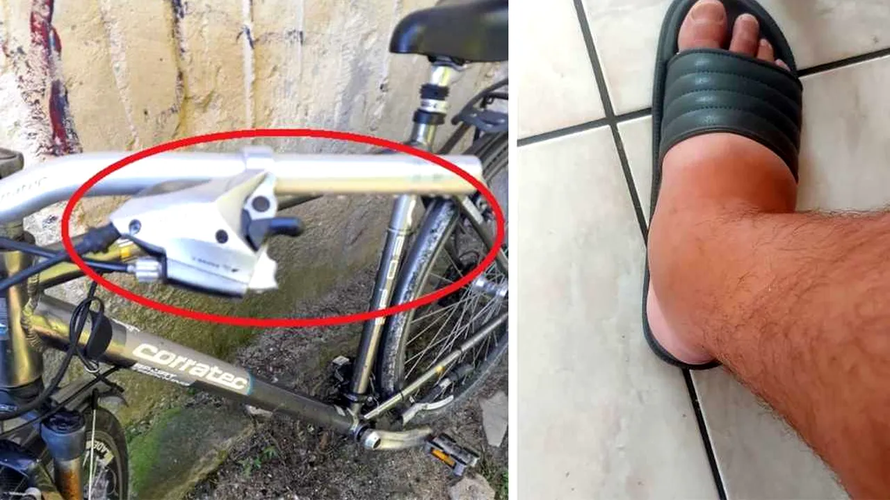 Ce mesaj i-a dat medicul spitalului din Urlați pacientului căruia i-a cusut în picior mânerul de la frâna de mână a unei biciclete