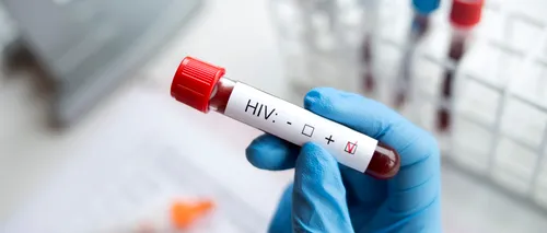 Mai mulți cercetători americani spun că este posibil să fi vindecat o pacientă de HIV