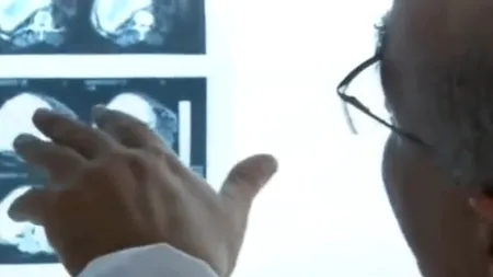 O femeie a fost însărcinată timp de 46 de ani. Ce au descoperit medicii la operație