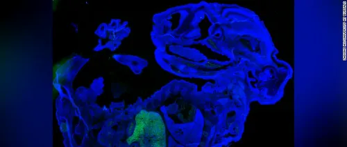 ȘTIINȚĂ. Cercetătorii au creat un embrion de șoarece cu ADN uman. Are cel mai mare procent de celule umane! Contribuția demersului științific în lupta împotriva COVID-19 - FOTO