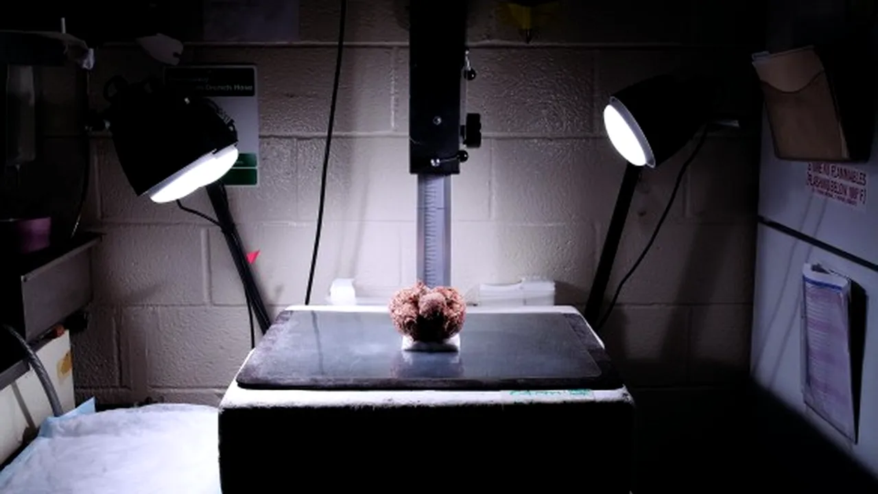 Cum arată cea mai mare bancă de creiere umane din lume, unde sunt stocate peste 9000 de creiere