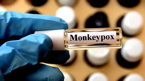 Expert OMS despre vaccinul împotriva variolei maimuței: ”Nu este un medicament miraculos”