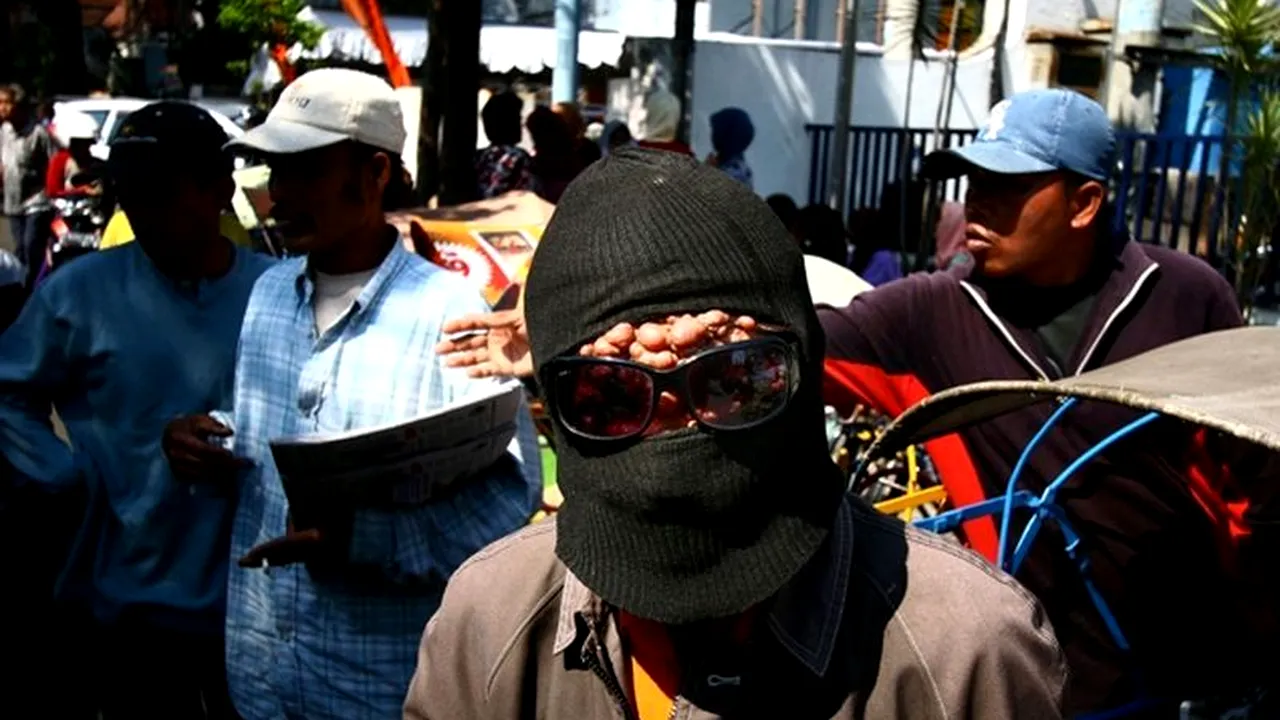 Un bărbat din Indonezia este MĂCINAT de o boală ciudată. „Oamenii se holbează la mine, le e frică și mă evită