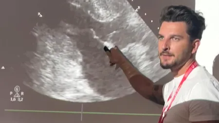 Apelul unui medic ATI, după moartea lui Ion Iliescu: „Nimeni nu merită un asemenea sfârșit”