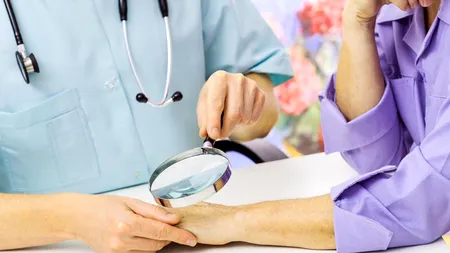 Peste 3 milioane de oameni sunt diagnosticați anual cu o boală care, depistată la timp, poate fi tratată complet