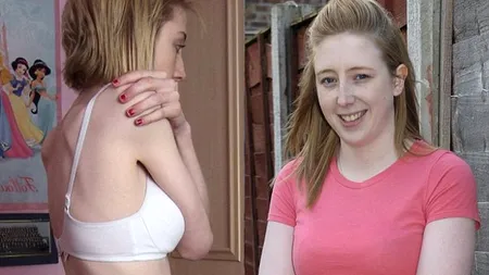 ANOREXIA face victime. Cazul unei adolescente NORMALE care a vrut să arate ca DIVELE din reviste