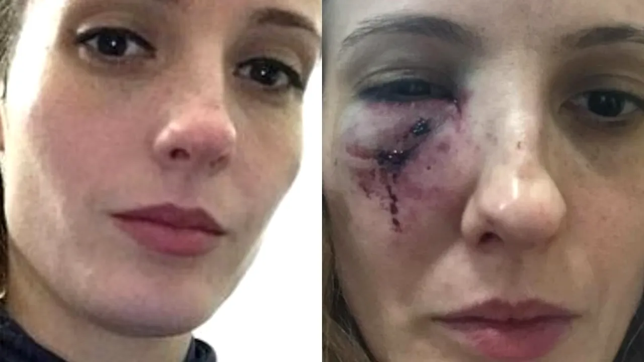 Româncă bătută cu brutalitate de o gașcă de adolescenți britanici. „Au luat foc. Au spus că sunt poloneză și că merit o lecție. Poliția nu a intervenit