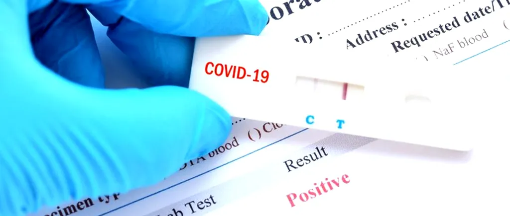 Testele rapide pentru coronavirus, aflate în România, nu sunt de încredere. Anunțul făcut de un cunoscut medic: “S-au folosit mult, fără să aibă relevanță!”