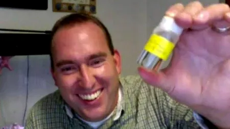 I s-a umflat buza și nu știa de ce. A scos de acolo un vierme