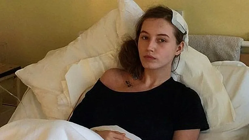 Această adolescentă din Polonia s-a trezit în timpul unei operații pe creier. Ce i-a întrebat pe chirurgi