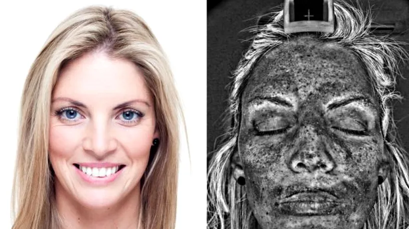 FOTO. Cum arată în realitate pielea după ședințele de bronzat de la solar