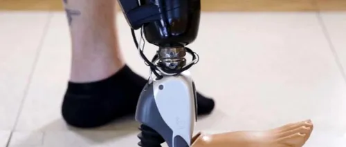 Noi senzori le permit persoanelor cu membre amputate să își miște picioarele bionice prin puterea gândului