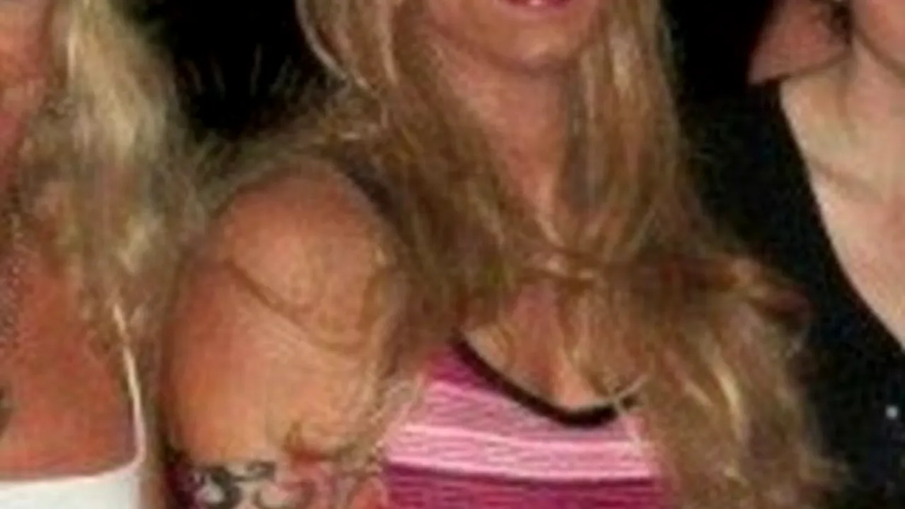 Pastilele împotriva căderii părului l-au transformat în FEMEIE. 