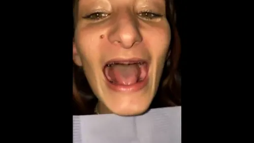 Dentistul groazei: I-a scos toți dinții din gură unei paciente! Cum arată tânăra după ce a primit o dantură nouă (VIDEO)