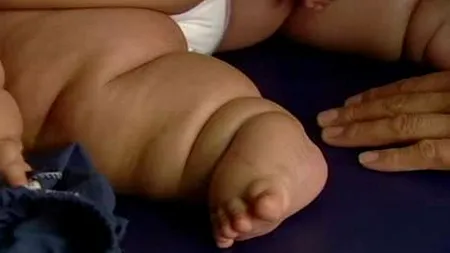 Cântărește de trei ori mai mult decât în mod normal. Cum arată bebelușul care are 21 KG la 8 luni