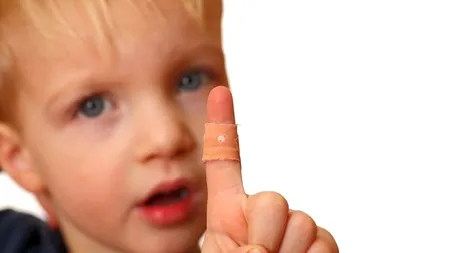 Ce sunt și cum putem scăpa de negi