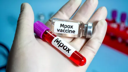Congo și alte țări africane ar putea începe vaccinarea împotriva variolei maimuței în câteva zile