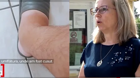 Ce spune tânărul căruia un medic de la Spitalul Urlați i-a ”uitat” frâna bicicletei în picior: ”M-au tăiat. Am rămas şocaţi toţi”