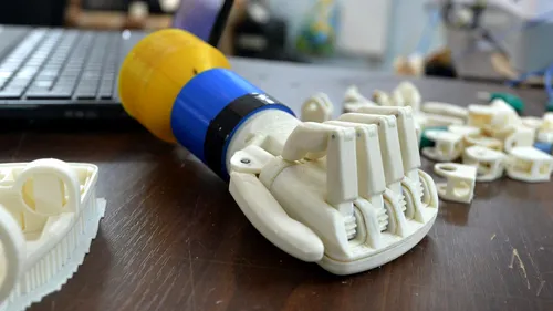 Cum au evoluat protezele. De la cârligul lui Captain Hook la penisul bionic