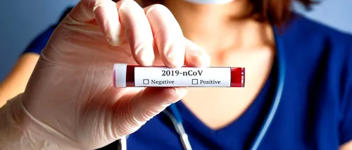 883 de cazuri noi de <i class='ep-highlight'>coronavirus</i> au fost raportate în România, în ultimele 24 de ore. Numărul de teste efectuate este de doar 7.247