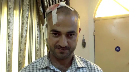 Un reporter AFP a fost rănit grav în Irak, în timpul ultimelor atentate cu mașini-capcană