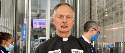 Motivul pentru care un preot britanic și-a cusut buzele. Totul a fost filmat (VIDEO)