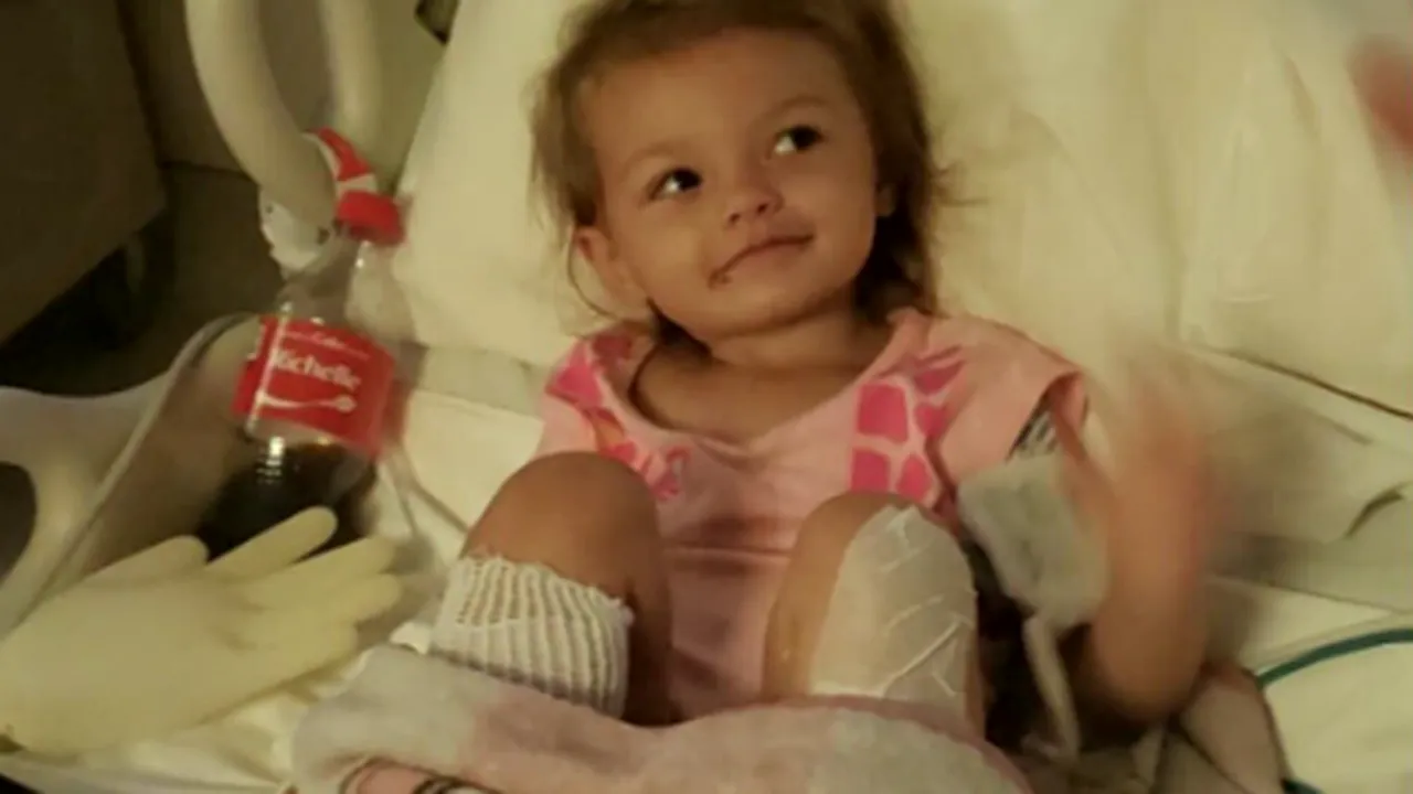 O fetiță de doar 2 ani este în stare gravă, după ce bunica vitregă a băgat-o în apă fiartă. Micuța riscă să i se amputeze picioarele - FOTO