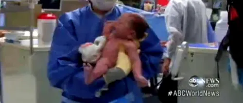 Intervenție chirurgicală miraculoasă în cazul unui bebeluș căruia nimeni nu îi dădea șanse