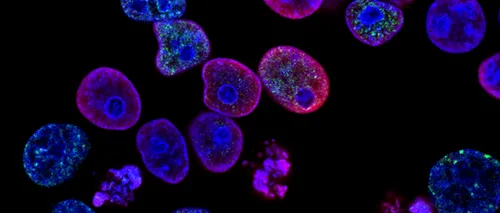 Primele celule artificiale care ar putea lupta împotriva cancerului. Sunt o alternativă promițătoare la tratamentele obișnuite