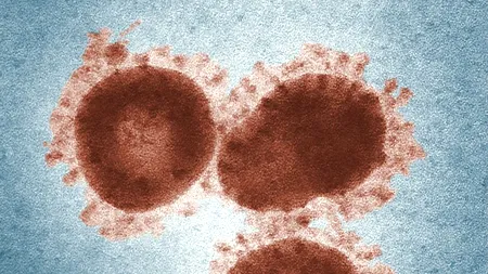 CORONAVIRUS poate avea o amprentă vocală unică. A fost lansat un studiu pentru a analiza vocile pacienților confirmați cu coronavirus