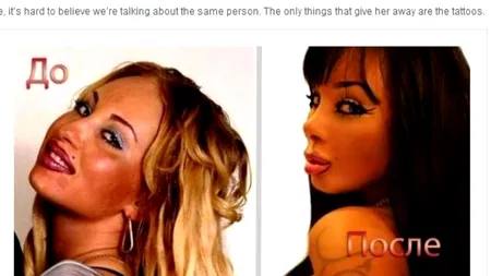 Cum a ajuns să arate o artistă de 25 de ani, după ce a suferit 13 operații estetice majore