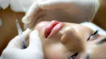 O adolescentă era să își piardă o parte din buză după o injecție cu acid hialuronic. Procedura, făcută de o femeie fără pregătire medicală