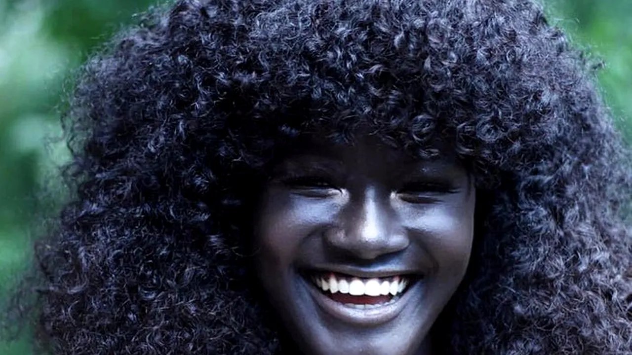 GALERIE FOTO. Tânără batjocorită pentru culoarea pielii sale, ajunsă celebră pe internet cu pozele sale: 