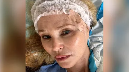 Fostul supermodel Christie Brinkley a aflat că are CANCER, întâmplător, la un control dermatologic al fiicei sale. Ce a văzut medicul pe fața ei