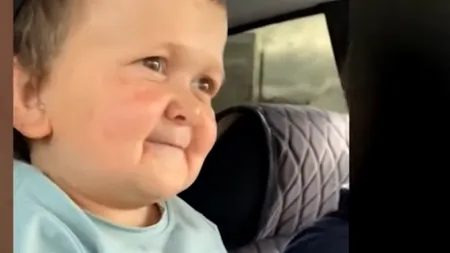 Tânăr cu o boală rară, viral pe rețelele de socializare (VIDEO)