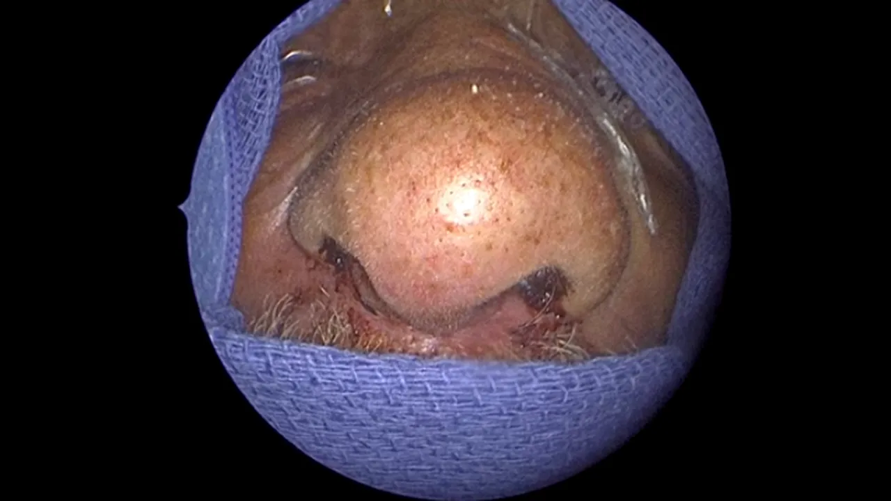 Erau 150! DESCOPERIRE tulburătoare făcută în nasul unui bărbat