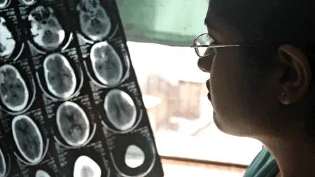 Peste 40% din populația planetei suferă de boli neurologice. OMS vrea reuniune de urgență