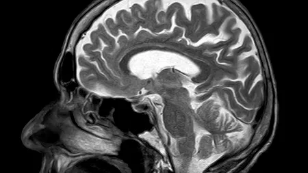Inteligența scăzută, asociată cu credința în teorii ale conspirației și paranormal