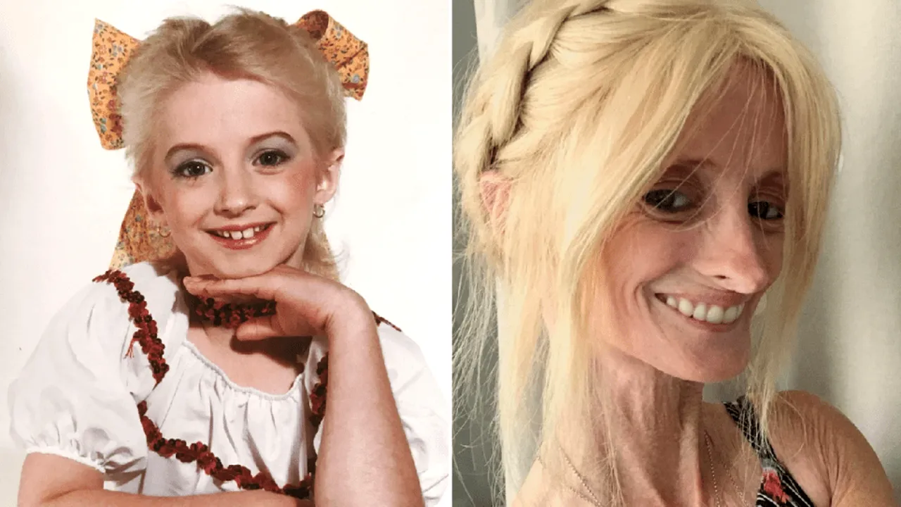 Povestea incredibilă a femeii care îmbătrânește de 8 ori mai repede decât ceilalți oameni: „Mi-am dat seama când au început să-mi cadă dinții că...” - FOTO