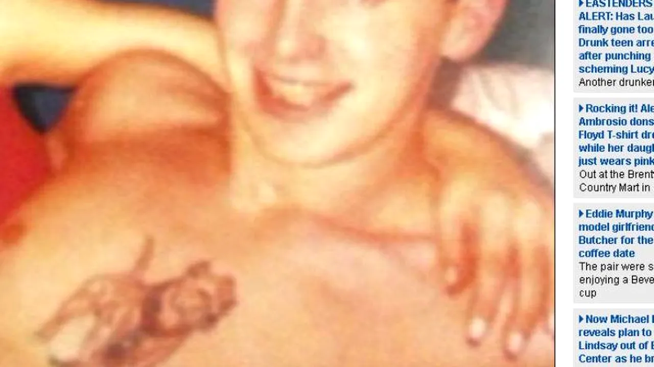 Ce a pățit un bărbat care a făcut un tratament cu substanțe chimice pentru a scăpa de un tatuaj