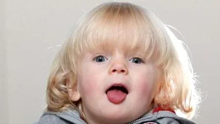 Micuțul adorabil din imagine suferă de o boală cumplită. 