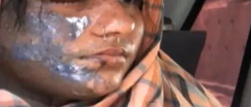 VIDEO. O cântăreață din Pakistan, în stare critică, după ce a fost atacată cu acid: A fost cerută în căsătorie dar l-a refuzat