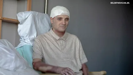 Primele imagini cu medicul Cătălin Denciu, transferat în Belgia după incendiul de la Piatra Neamț: „Recuperarea este departe de a se termina, dar știu că trebuie să dau totul” - FOTO