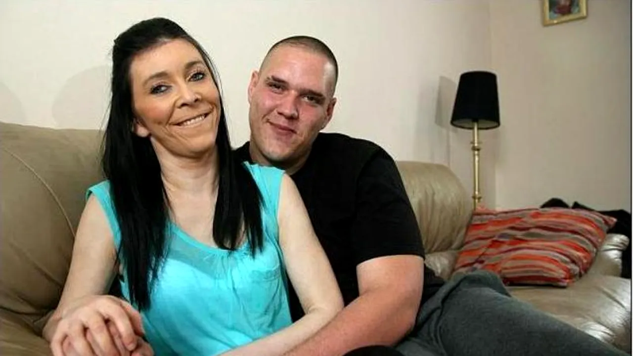 A ajuns la chirurgul estetician din cauza unei boli rare