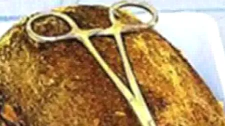 S-a dus la doctor pentru că o durea burta. Medicii au rămas ȘOCAȚI când au descoperit ce era în stomacul ei